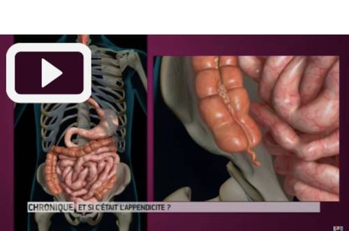 Vous n'arrivez pas à voir les images ? Contactez-nous sur jean@artips.fr