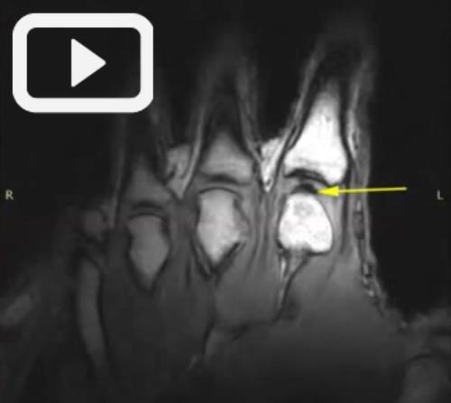 Vous n'arrivez pas à voir les images ? Contactez-nous sur jean@artips.fr